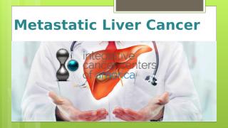 Metastatic Liver Cancer.pptx